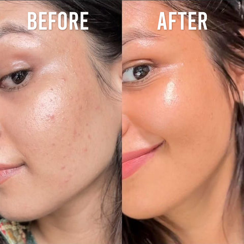 Advanced Skin Glow System