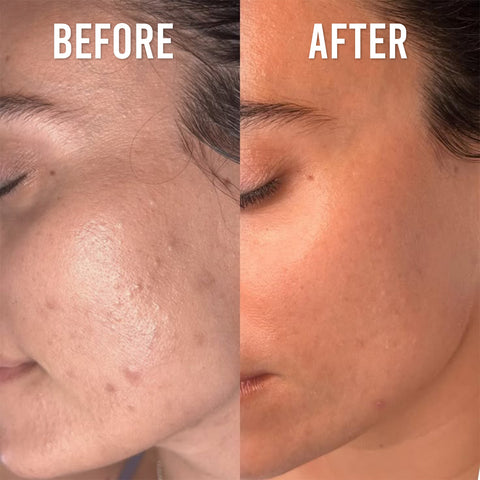 Advanced Skin Glow System