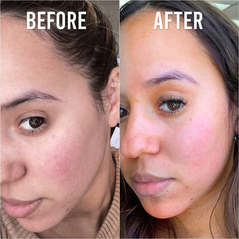 Advanced Skin Glow System